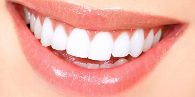دندان‌های سفید، شفاف و براق، استحکام و سلامت کم‌تری دارند