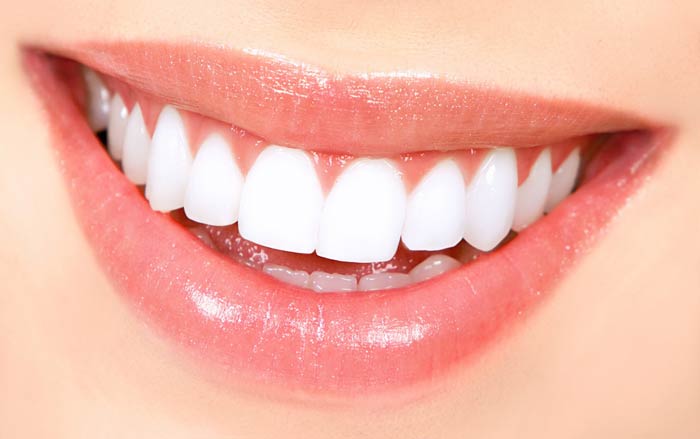 دندان‌های سفید، شفاف و براق، استحکام و سلامت کم‌تری دارند