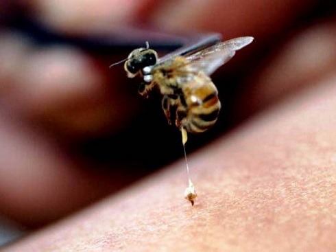 درمان زنبور گزیدگی چطور انجام می شود؟ 4 bee bite01