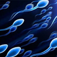 تقویت اسپرم با رعایت 3 نکته