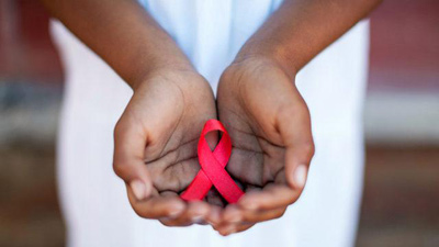 ویروس HIV, اولین نشانه های HIV
