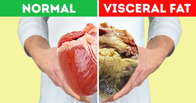  آب کردن چربی احشایی شکم, چربی احشایی شکم چیست