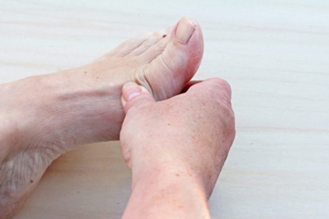 علل، علائم و درمان درد انگشتان پا