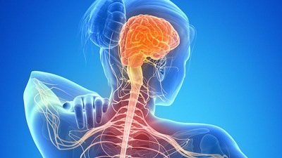 سردردهایی که با خوردن مسکن تشدید میشود 5 headaches aggravated1 1